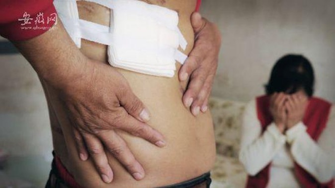 Après une opération, il s&rsquo;aperçoit que son rein droit a disparu