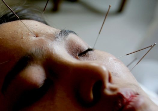 Acupuncture et médecine chinoise pour la santé mentale (I)