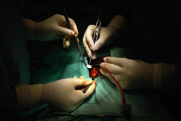 D’étranges phénomènes observés après des transplantations cardiaques