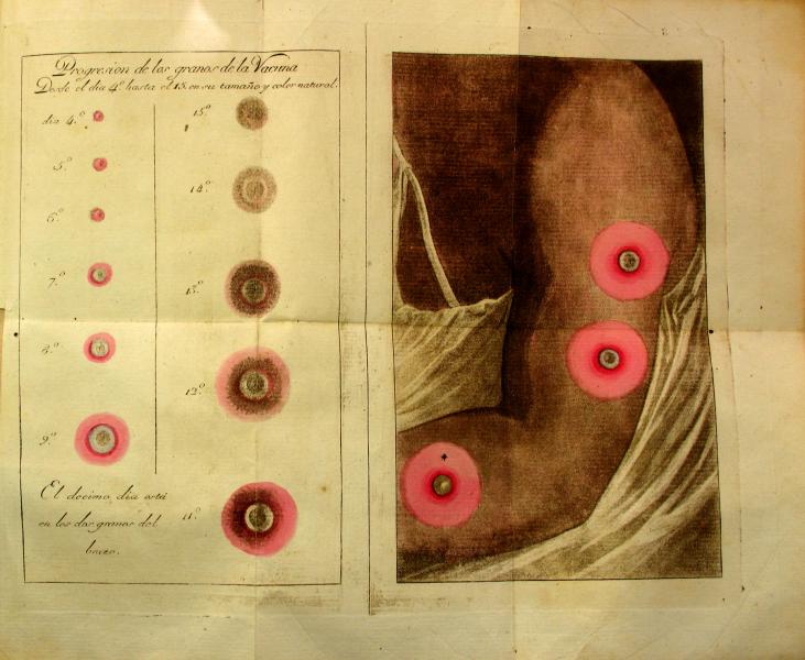 De l&rsquo;inoculation au vaccin moderne, un millénaire d’immunisation