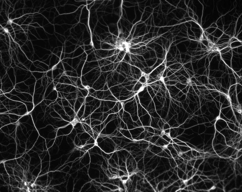 Deep learning, des réseaux de neurones pour traiter l’information