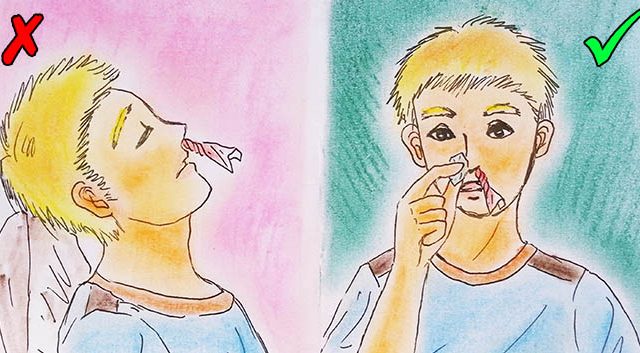 8 techniques de premier secours souvent mal appliquées, voici comment bien les faire