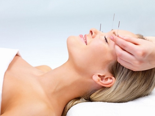 Traitement du cancer du sein: l’acupuncture, une aide précieuse