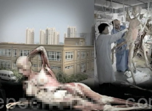 Les prélèvements forcés d’organes dénoncés aux Nations Unies à Genève