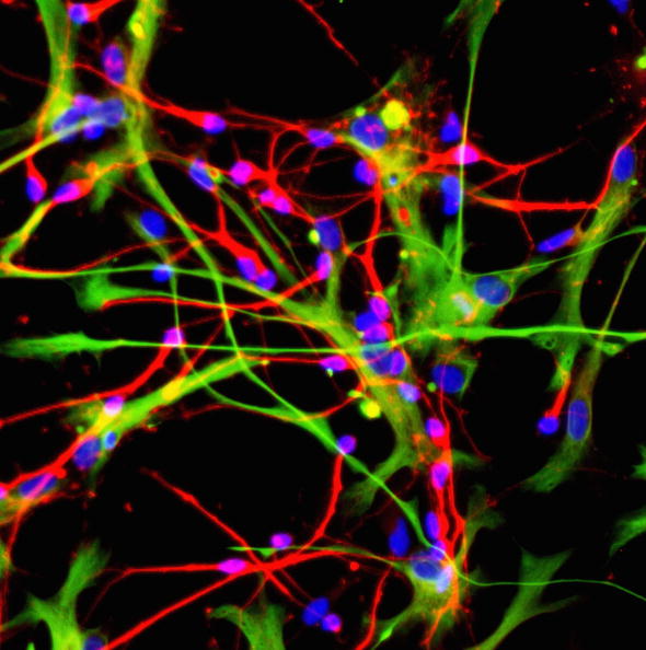 Japon : essai sur l&rsquo;homme d&rsquo;un traitement de Parkinson par cellules souches iPS