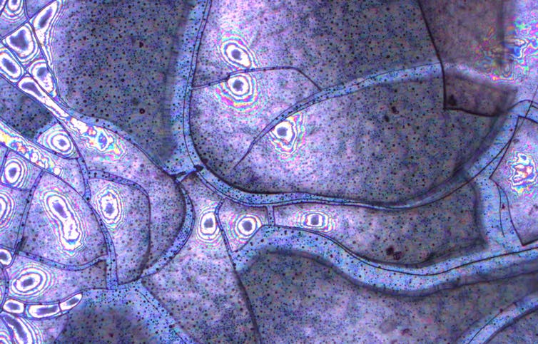 Exposition aux nanoparticules : un risque pour le cerveau à prendre très au sérieux