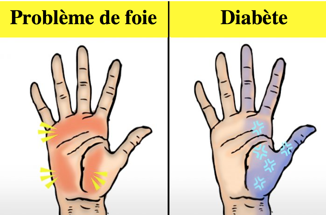 10 choses que vos mains peuvent révéler au sujet de votre santé – Vos mains ont-elles parfois des fourmillements?