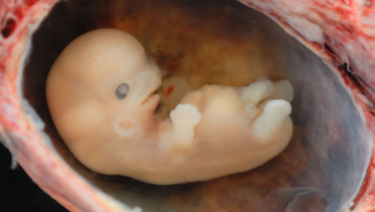 Erreur de fécondation in vitro : une femme accouche de l&rsquo;enfant d&rsquo;une autre en Australie