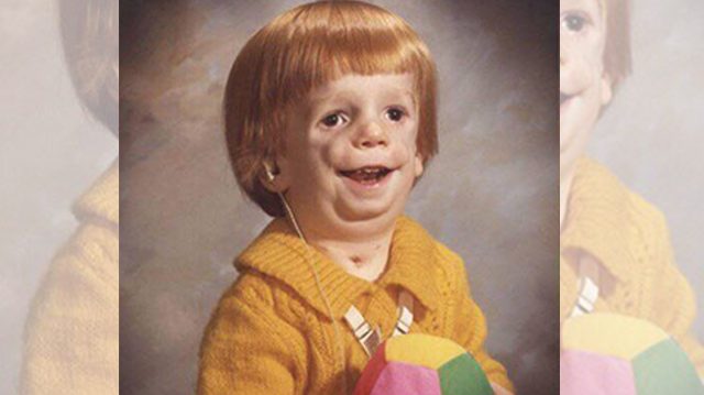 Intimidé pour son « physique » dans son enfance, il a tenté deux fois de se suicider, mais aujourd&rsquo;hui, il est pédiatre