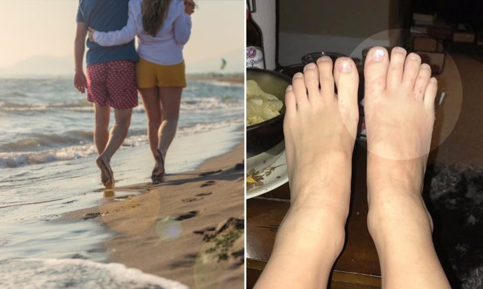 Des dizaines de vers s&rsquo;introduisent dans les pieds sans chaussures d&rsquo;un couple pendant leurs vacances sur une plage des Caraïbes
