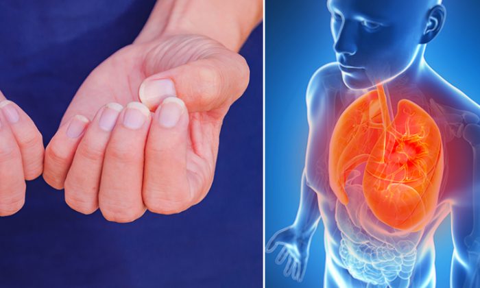 Qu&rsquo;indiquent vos ongles sur votre santé selon la médecine occidentale?