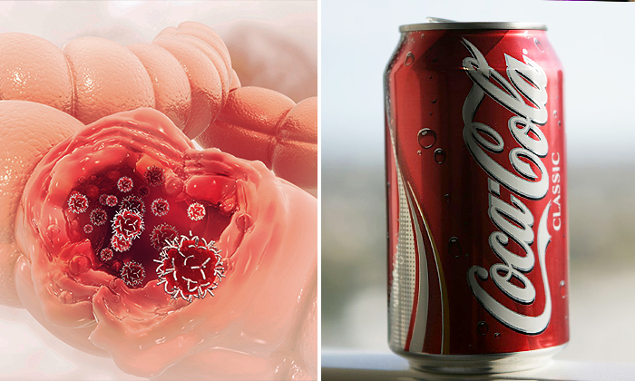 Les boissons sucrées sont mauvaises pour l&rsquo;intestin et stimulent la croissance des tumeurs cancéreuses