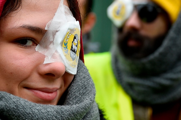 « Gilets jaunes »: des blessés créent un collectif et appellent à une manifestation nationale