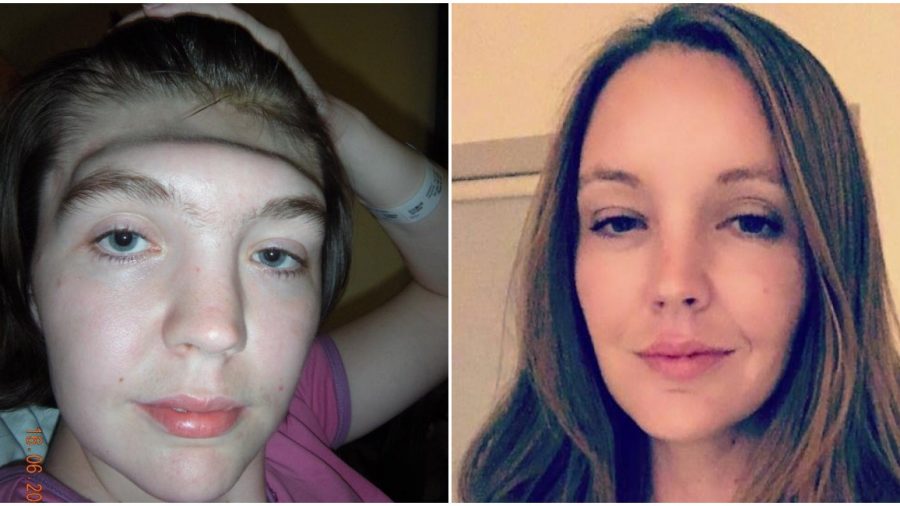 Attention aux pieds sur le tableau de bord : une femme ayant perdu son front dans un accident de voiture met en garde