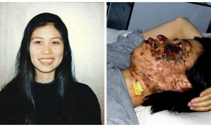 Un visage détruit : l&rsquo;histoire derrière cette photo qui montre au monde entier la brutalité du régime chinois