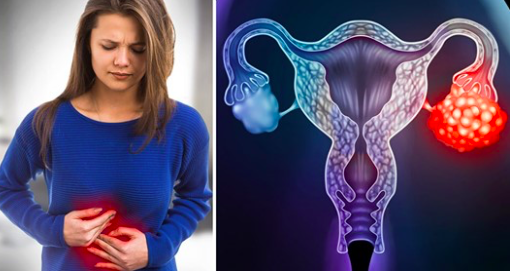 5 signes qui pourraient signaler un cancer de l’ovaire – les stades précoces sont difficiles à détecter, voici comment