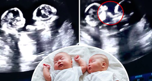 Une échographie montre un «combat de boxe hilarant» entre des jumeaux identiques dans l’utérus