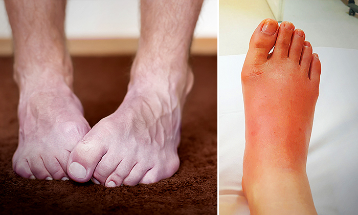 10 choses que vos pieds révèlent sur votre santé – vos pieds sont-ils toujours froids ?