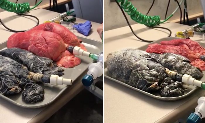 Une vidéo stupéfiante expose les effets nocifs du tabagisme sur les poumons