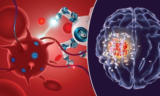 Une scientifique pionnière invente un traitement à base de nanotechnologies qui pourrait guérir la SEP et donner de l’espoir à des millions de gens
