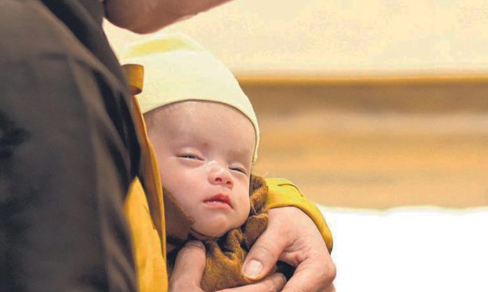 Un bébé prématuré avec une blessure à la tête infestée d&rsquo;asticots, trouvé dans un sac plastique, se bat pour sa vie