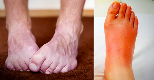 10 choses que vos pieds révèlent sur votre santé – Vos pieds sont-ils froids tout le temps ?