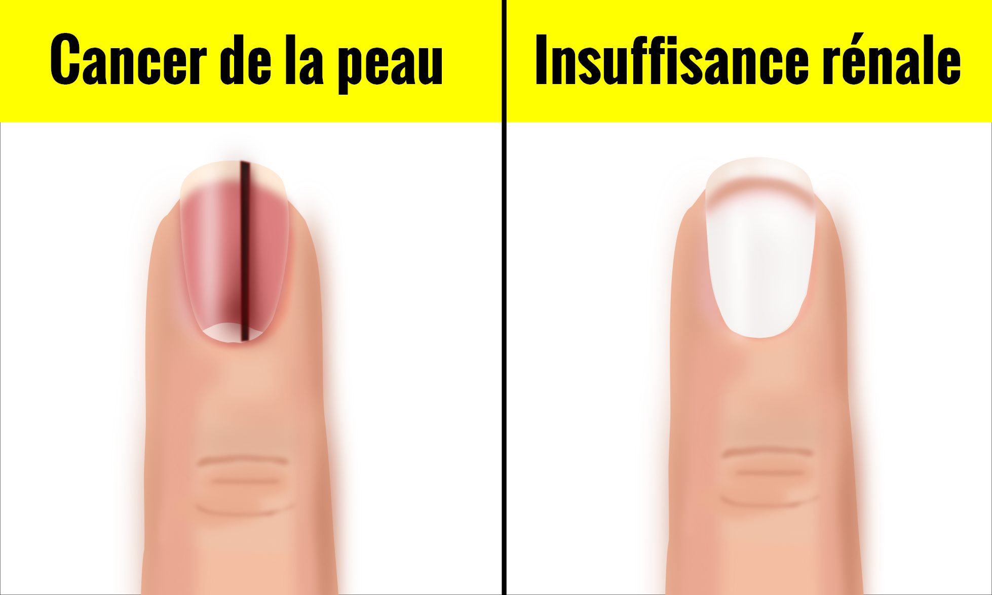 Voici 10 aspects de vos ongles qui peuvent aider à vous renseigner sur votre santé