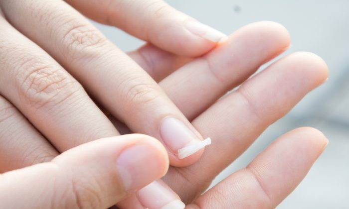 Une mise en garde d’une femme devient virale après avoir découvert que des ongles courbés sont un signe de cancer du poumon