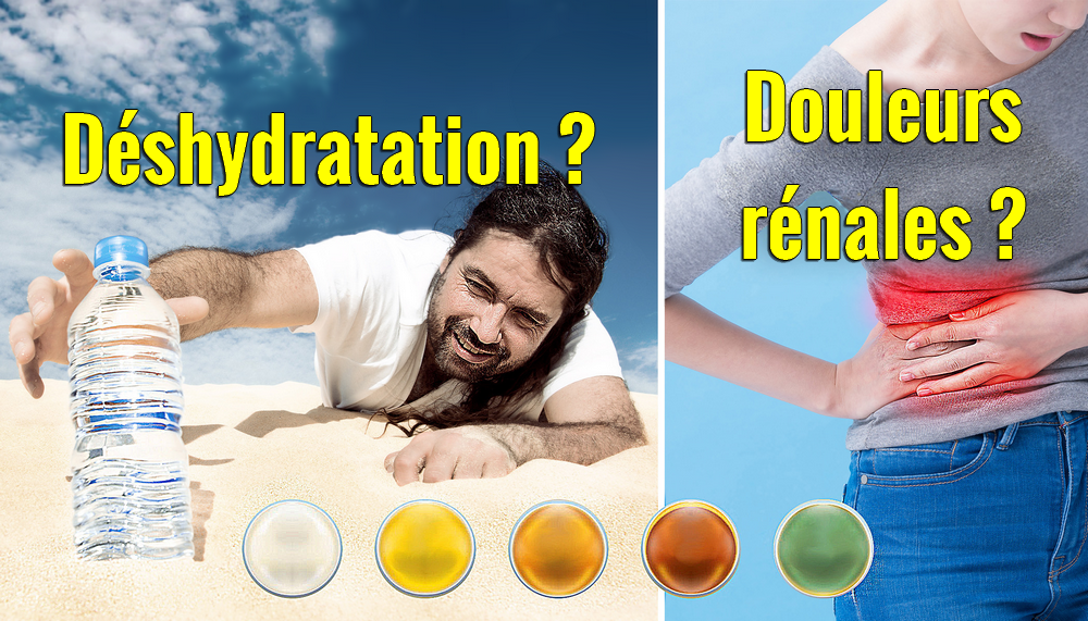 Que dit la couleur de l’urine sur votre santé ? 5 couleurs d’urine et ce qu’elles signifient (Oui, l’urine verte existe)