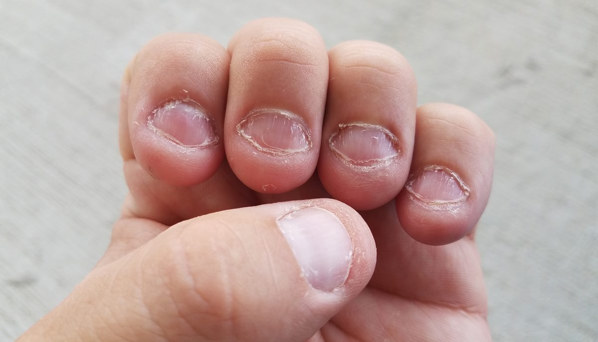Ceux qui se rongent les ongles ne sont pas juste nerveux mais ont une personnalité particulière