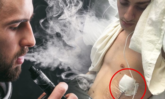 Un ado au seuil de la mort après avoir vapoté pendant une année partage d’horrifiantes images