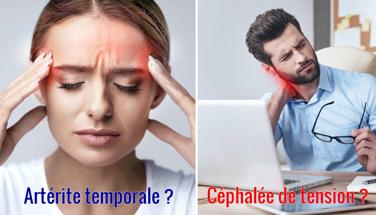 Vos maux de tête ne s’arrangent pas? Voici 10 types différents de maux de tête et comment les traiter
