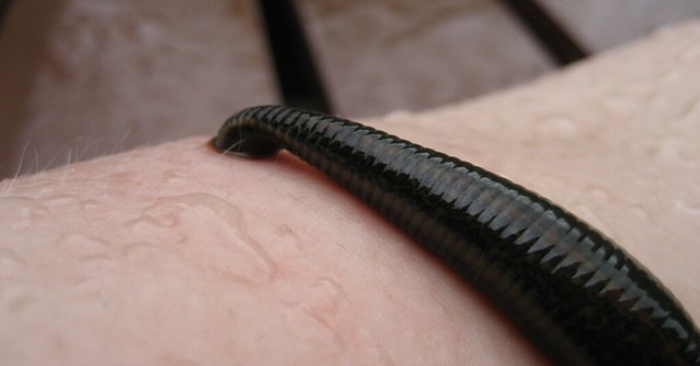 Une sangsue vivante de près de 8 cm de long a été extraite vivante de la gorge d&rsquo;un enfant qui crachait du sang