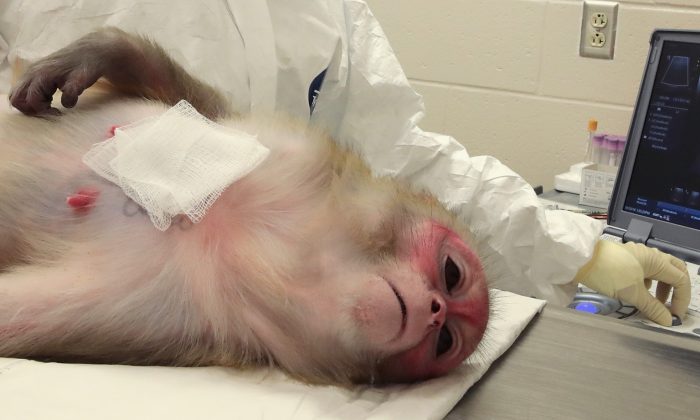 Des singes qui ont reçu des implants génétiques meurent au cours d&rsquo;expériences menées par des scientifiques chinois