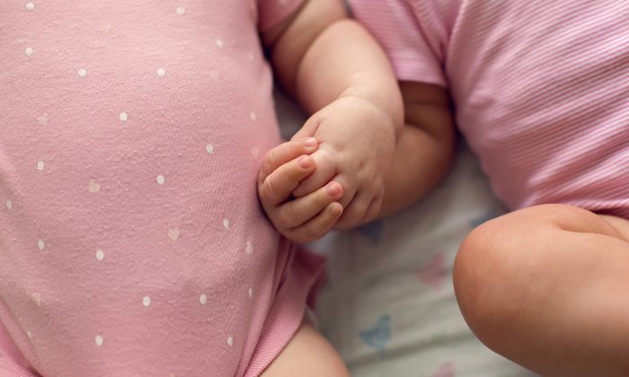 Des jumeaux siamois joints par la tête sont séparés après 27 heures de chirurgie – ils deviennent plus forts malgré les défis à relever