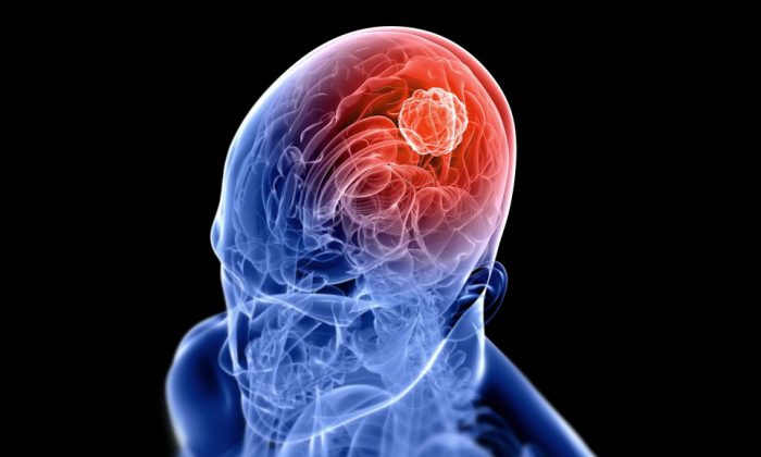 5 ingrédients qui empoisonnent votre cerveau