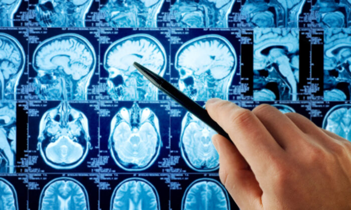 Des parents écrivent une liste de choses à faire pour leur fils mourant de 4 ans, dont le «sourire déformé» s&rsquo;est avéré être un cancer du cerveau