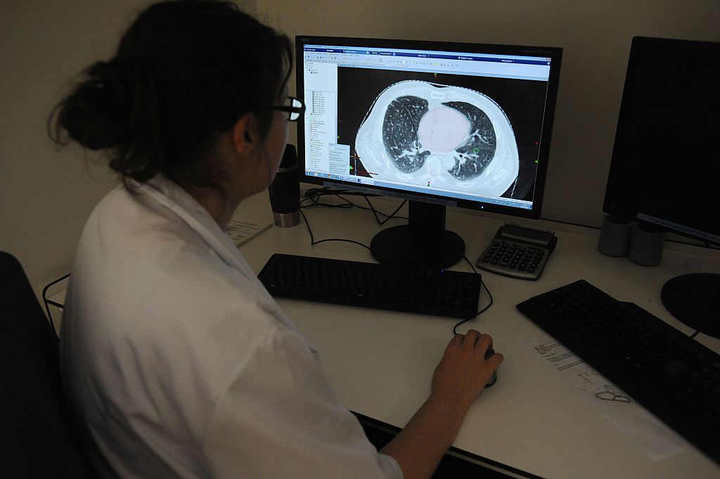 La gestion de l&rsquo;épidémie du Covid-19 a entraîné une surmortalité des cancers de 2 à 5%, selon une étude