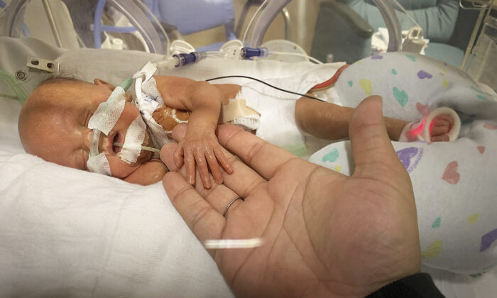 Un bébé né prématurément à 4 mois du terme rentre enfin à la maison après un an dans une unité néonatale de soins intensif