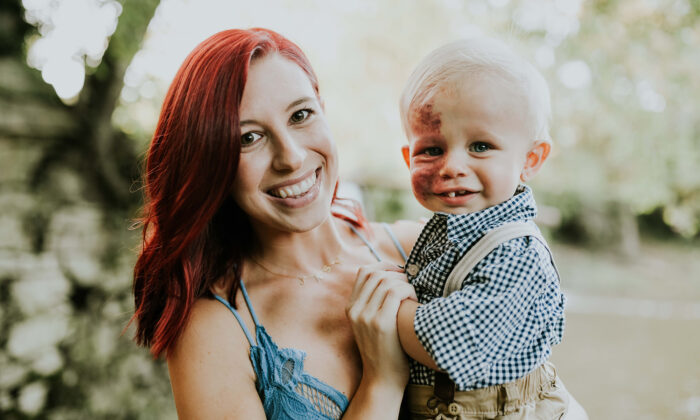 Un adorable bébé né avec une grande tache de naissance sur le visage est considéré comme « parfait » par sa mère