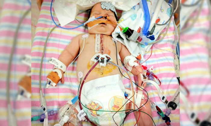 Un enfant atteint d&rsquo;une rare malformation cardiaque et cliniquement « décédé » 9 fois, est toujours là et souriant auprès de sa famille