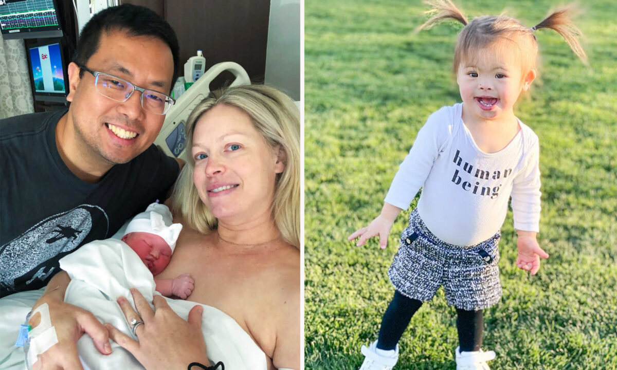 Un bébé miraculé atteint de trisomie 21 réussit à vivre malgré 5 % de chances de survivre