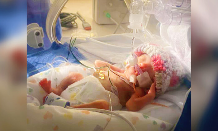 Une jumelle prématurée qui a perdu son frère à la naissance survit et rentre chez elle après 408 jours d&rsquo;hospitalisation