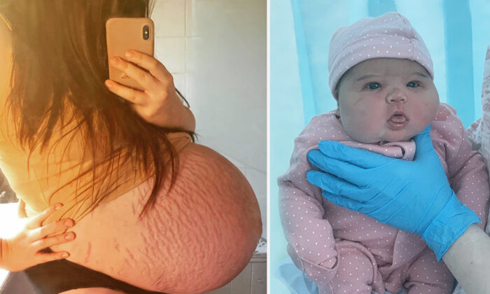 Une femme enceinte avait un ventre si imposant que les médecins ont pensé à un jumeau caché – elle donne naissance à un bébé de 5,9 kg