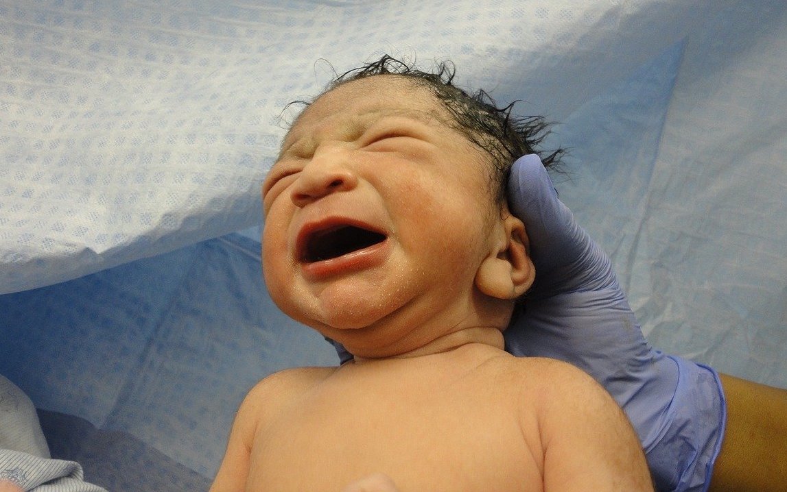 États-Unis: le visage d&rsquo;un nouveau-né entaillé après une césarienne