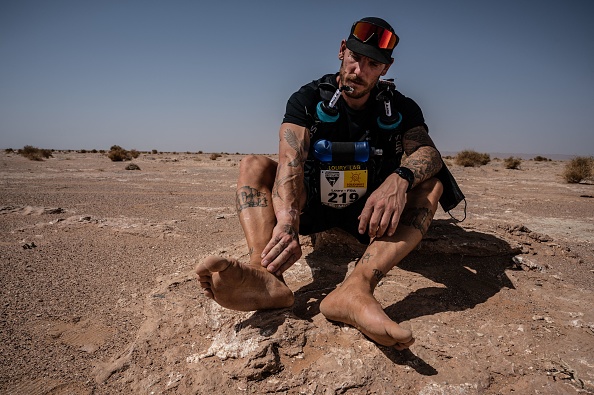 Marathon des Sables: Le coureur aux pieds nus et sa super glue pour les plaies