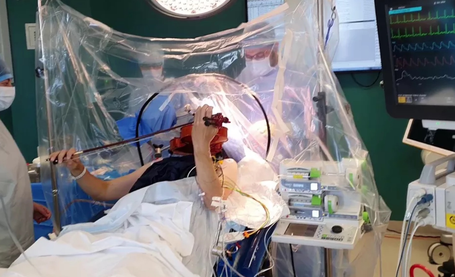 CHU de Caen : un musicien joue de l’alto pendant son opération du cerveau
