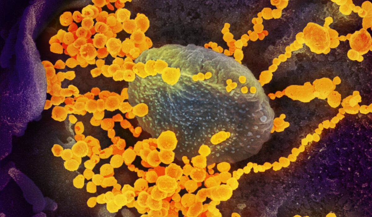 Détoxifier son corps des protéines spike: les 6 principaux médicaments et composés naturels