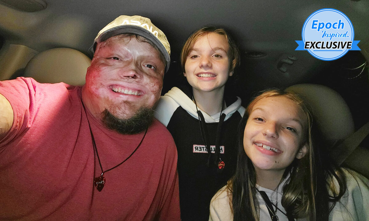 Brûlé à 98%, cet homme qui a survécu miraculeusement élève ses deux filles et remercie Dieu de l&rsquo;avoir maintenu en vie