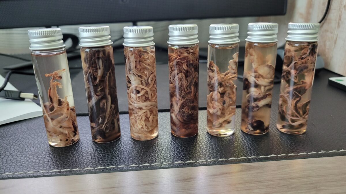 Les embaumeurs trouvent toujours plus de caillots longs et fibreux dans les corps, qui n&rsquo;ont pas les caractéristiques de caillots post-mortem